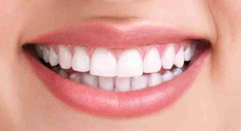 Ortodoncia con brackets estéticos — después